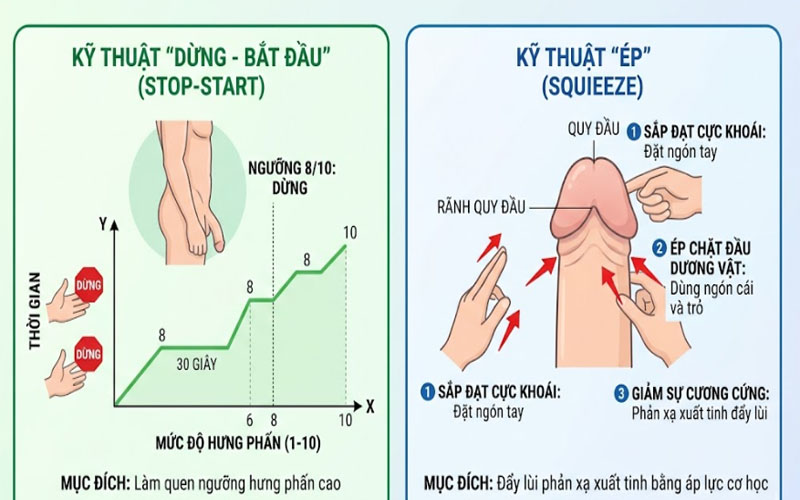 Sơ đồ hướng dẫn kỹ thuật Stop-Start và Squeeze 